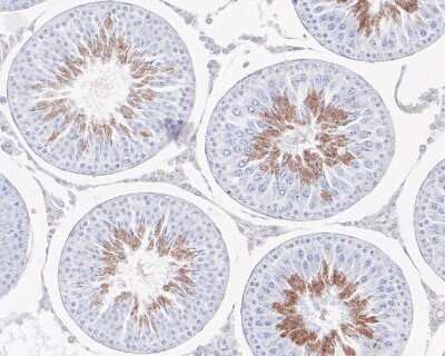 Immunohistochemistry-Paraffin: CaM Kinase II alpha Antibody (JM11-07) [NBP2-67207]