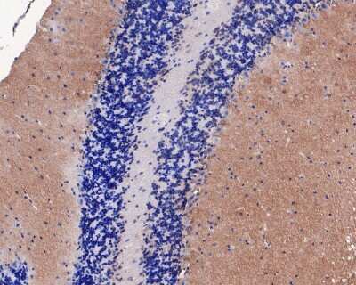 Immunohistochemistry-Paraffin: CaM Kinase II alpha Antibody (JM11-07) [NBP2-67207]