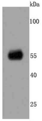 Western Blot: CaM Kinase II alpha Antibody (JM11-07) [NBP2-67207]