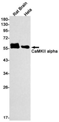 Western Blot: CaM Kinase II alpha Antibody (S09-9E5) [NBP3-19589]