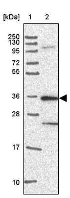 Western Blot: CaM Kinase II alpha Antibody [NBP2-46796]