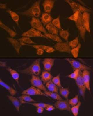 Immunocytochemistry/ Immunofluorescence: CaM Kinase II delta Antibody (10M1P2) [NBP3-16783]
