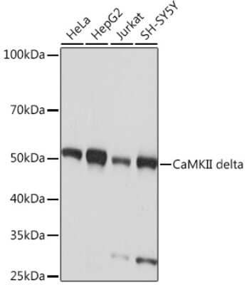 Western Blot: CaM Kinase II delta Antibody (10M1P2) [NBP3-16783]