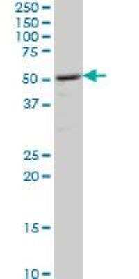 Western Blot: CaM Kinase II delta Antibody (1A8) [H00000817-M02]