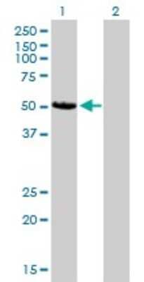 Western Blot: CaM Kinase II delta Antibody (1A8) [H00000817-M02]