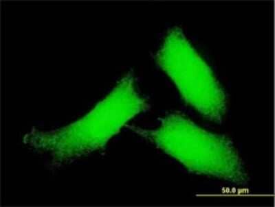 Immunocytochemistry/ Immunofluorescence: CaM Kinase II delta Antibody (2E1) [H00000817-M01]