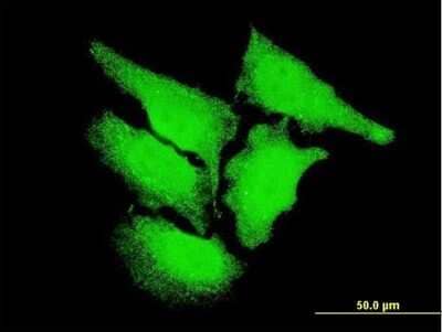 Immunocytochemistry/ Immunofluorescence: CaM Kinase II delta Antibody (4F9) [H00000817-M04]