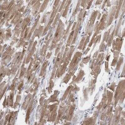 Immunohistochemistry-Paraffin: CaM Kinase II delta Antibody [NBP1-88211]