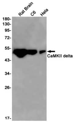 Western Blot: CaM Kinase II delta Antibody (S03-8A9) [NBP3-14913]