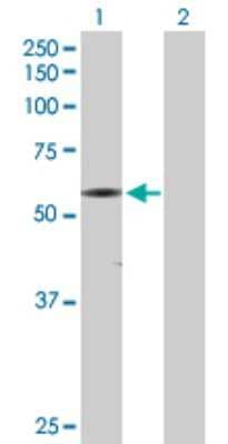 Western Blot: CaM Kinase II gamma Antibody [H00000818-D01P]