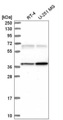 Western Blot: CaM Kinase II gamma Antibody [NBP2-57797]