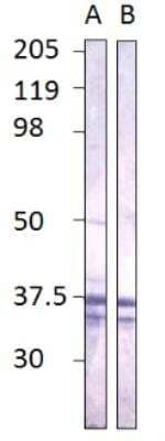 Western Blot: CaM Kinase II gamma Antibody [NBP3-12204]