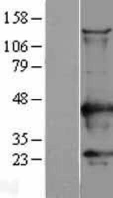 Western Blot: CaM Kinase I Overexpression Lysate [NBL1-08658]