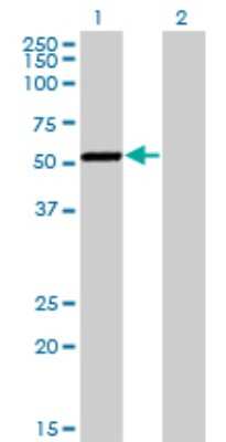 Western Blot: CaMKI gamma Antibody (3E2) [H00057172-M01]