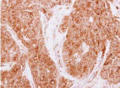 Immunohistochemistry-Paraffin: CaMKI gamma Antibody [NBP1-31624]