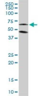 Western Blot: CaMKI gamma Antibody [H00057172-B01P]