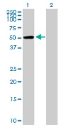 Western Blot: CaMKI gamma Antibody [H00057172-B01P]