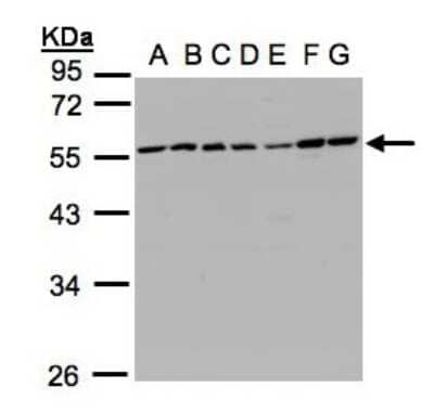 Western Blot: CaMKI gamma Antibody [NBP1-31624]