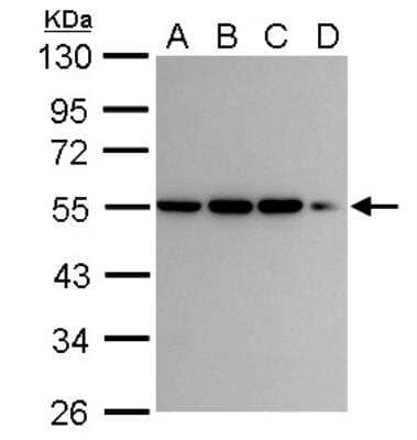 Western Blot: CaMKI gamma Antibody [NBP1-31624]