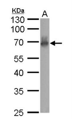 Western Blot: CaMKI gamma Antibody [NBP1-31624]