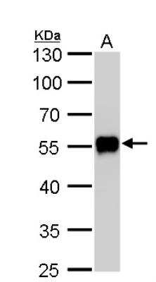 Western Blot: CaMKI gamma Antibody [NBP1-31624]