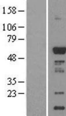 Western Blot: CaMKI gamma Overexpression Lysate [NBL1-08660]