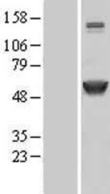 Western Blot: CaM Kinase II alpha Overexpression Lysate [NBL1-08661]