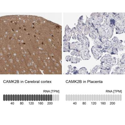 Immunohistochemistry-Paraffin: CaMKII beta Antibody [NBP1-88212]