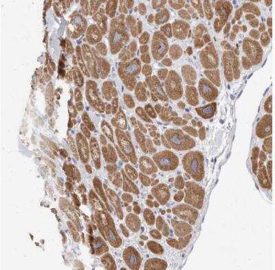 Immunohistochemistry-Paraffin: CaMKII beta Antibody [NBP1-88212]