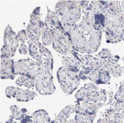 Immunohistochemistry-Paraffin: CaMKII beta Antibody [NBP1-88212]