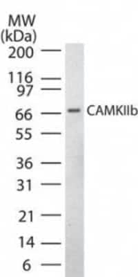 Western Blot: CaMKII beta Antibody [NB120-22131]