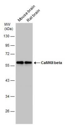 Western Blot: CaMKII beta Antibody [NBP3-13157]