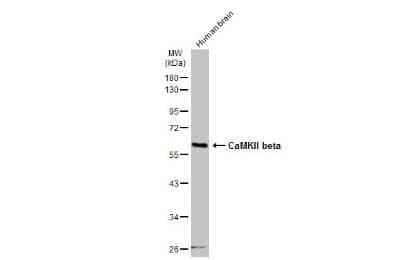 Western Blot: CaMKII beta Antibody [NBP3-13157]