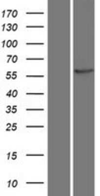 Western Blot: CaMKII beta Overexpression Lysate [NBP2-05191]