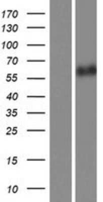 Western Blot: CaMKII beta Overexpression Lysate [NBP2-05192]