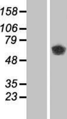 Western Blot: CaMKII beta Overexpression Lysate [NBP2-05193]