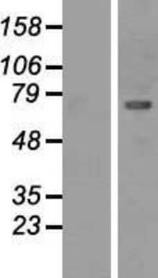 Western Blot: CaMKII beta Overexpression Lysate [NBP2-10965]