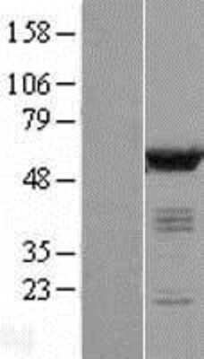 Western Blot: CaM Kinase II delta Overexpression Lysate [NBL1-08664]