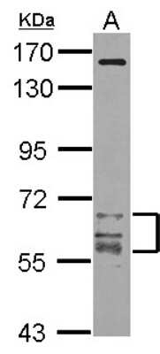 Western Blot: CaM Kinase II gamma Antibody [NBP2-15686]