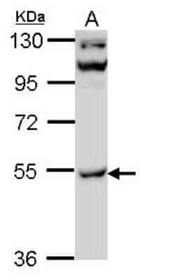 Western Blot: CaM Kinase II gamma Antibody [NBP2-15686]