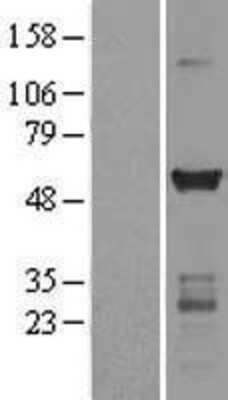 Western Blot: CaM Kinase II gamma Overexpression Lysate [NBL1-08665]