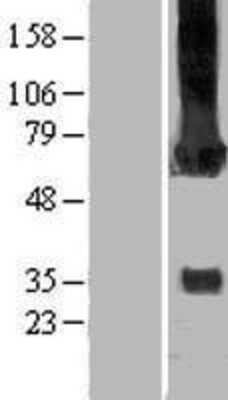 Western Blot: CaM Kinase II gamma Overexpression Lysate [NBP2-05180]