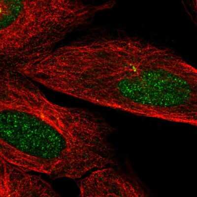 Immunocytochemistry/ Immunofluorescence: CaMKIIN2 Antibody [NBP2-58609]