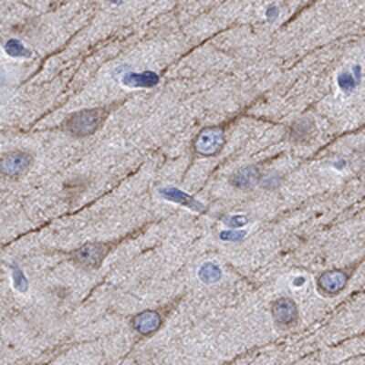 Immunohistochemistry-Paraffin: CaMKIIN2 Antibody [NBP3-17473]