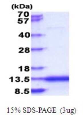 SDS-PAGE: Recombinant Human CaMKIIN2 His Protein [NBP2-51788]