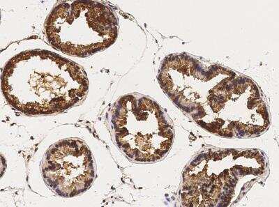 Immunohistochemistry-Paraffin: CaMKIV Antibody (001) [NBP2-90733]