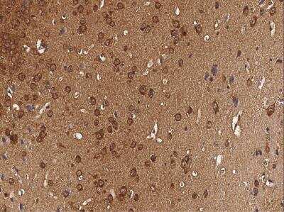 Immunohistochemistry-Paraffin: CaMKIV Antibody (001) [NBP2-90733]