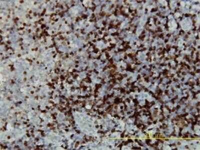 Immunohistochemistry-Paraffin: CaMKIV Antibody (1A3) [H00000814-M01]