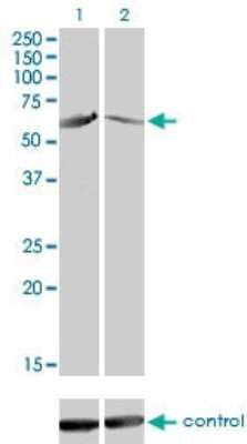 Western Blot: CaMKIV Antibody (1A3) [H00000814-M01]