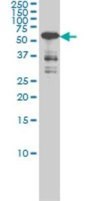 Western Blot: CaMKIV Antibody (1A3) [H00000814-M01]